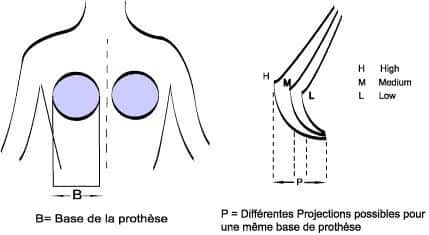 prothèse mammaire à base circulaire