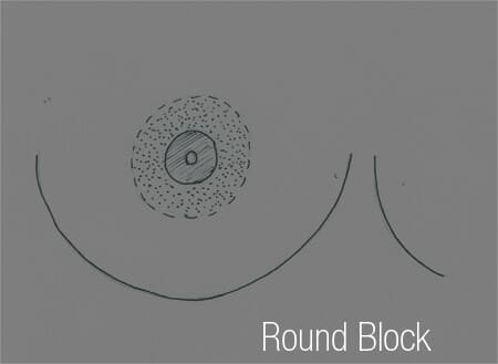 round block pour petites ptoses mammaires